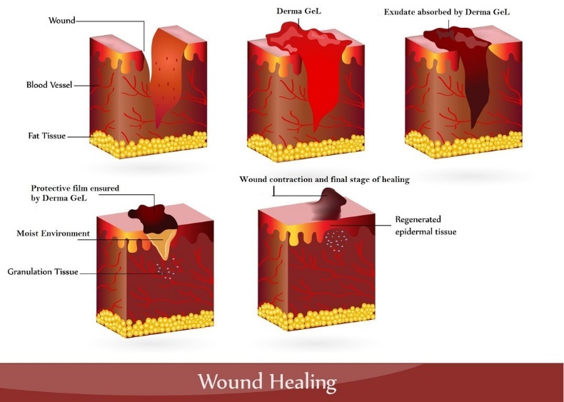 woundhealing
